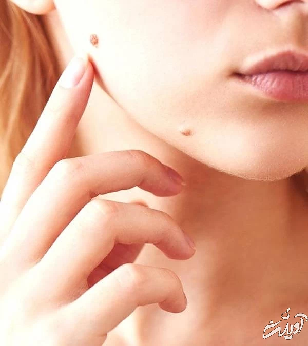 شخصیت شناسی از روی خال شخصیت شناسی خال